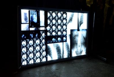 X-ray images  on a Large Light-/viewBox 220v