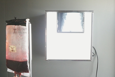 X-ray image on a Small Light/View-Box 220v